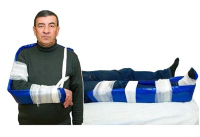 Комплект шин транспортных лестничных КШТЛ-МП-01 0280201